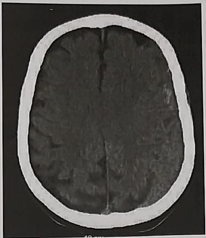 Dossier CVi Test EVC PAE